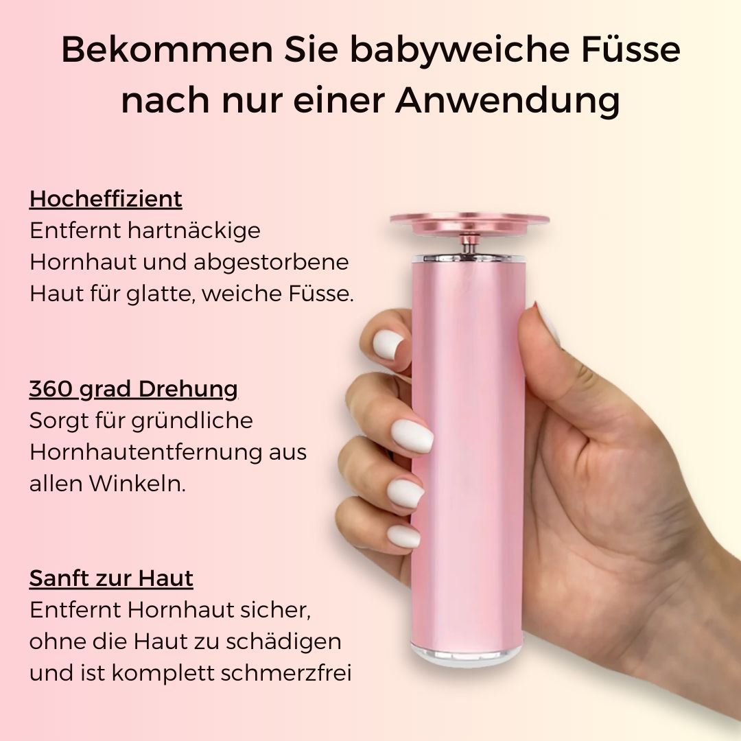 SoftFeet Pro™ - Elektrischer Hornhaut Entferner